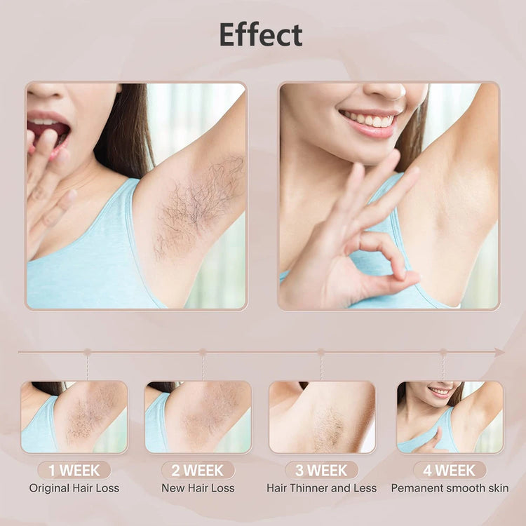 Hair removal for women with painless IPL technology and 999999 flashes for long-term smooth skin.