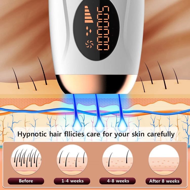 Hair removal for women with painless IPL technology and 999999 flashes for long-term smooth skin.