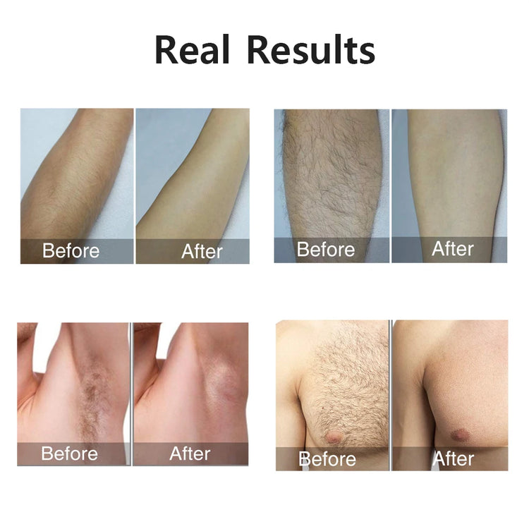 Hair removal for women with painless IPL technology and 999999 flashes for long-term smooth skin.