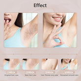  Hair removal for women with painless IPL technology and 999999 flashes for long-term smooth skin.