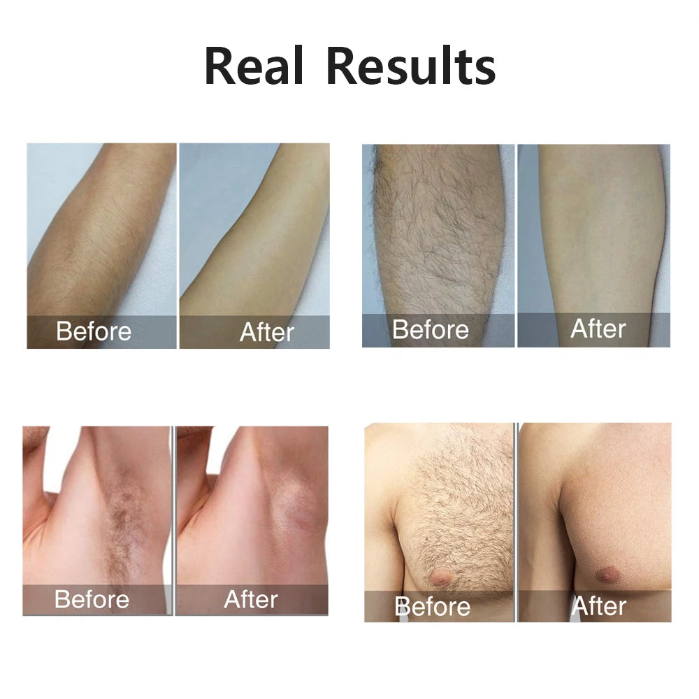  Hair removal for women with painless IPL technology and 999999 flashes for long-term smooth skin.