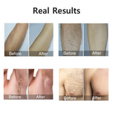  Hair removal for women with painless IPL technology and 999999 flashes for long-term smooth skin.
